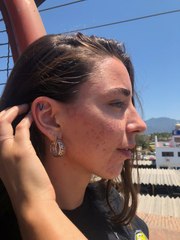 Ex-vegan whose hair started to fall out in chunks says quitting the diet 'saved her life'