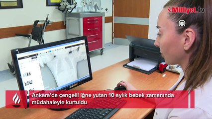 10 aylık bebeğinin yakasına çengelli iğne ile dua taktı! Korkunç manzara