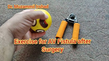 Top Exercises for Arteriovenous Fistula for Dialysis