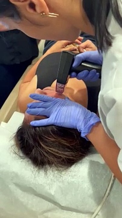 non surgical face lift Glenview