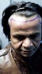 Video: राजपाल यादव की हुई सर्जरी, सोशल मीडिया पर वायरल हुआ वीडियो, लोग बोले- बढ़ती उम्र में....