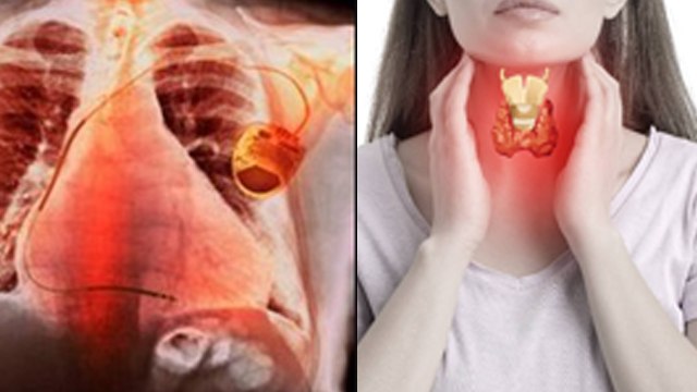 Heart Enlargement Problem: Symptoms, Causes In Hindi| Why Heart Size Increases | Boldsky