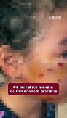 Pit bull ataca menina de três anos em pracinha; veja o vídeo