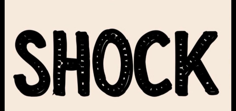 Shock. Types of shock cardiogenic shock, hypovolemic shock ,obstructive shock ,septic shock, sign symptoms, causes, medical surgical nursing