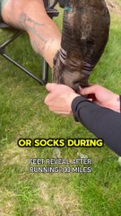 Why You Must Change Socks During a Marathon – Shocking 100 Mile Foot Reveal! #shorts