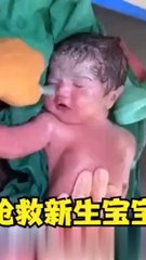 There is no movement in the baby after birth | new born baby 