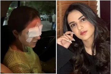 आंखें खराब होने के बाद Jasmin Bhasin का पहला वीडियो आया सामने