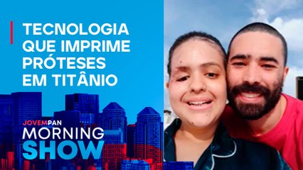 FACE de mulher atingida por colheitadeira é RECONSTRUÍDA; casal EXPLICA procedimento