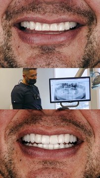 Exceptional Care At Tri City Dental Care