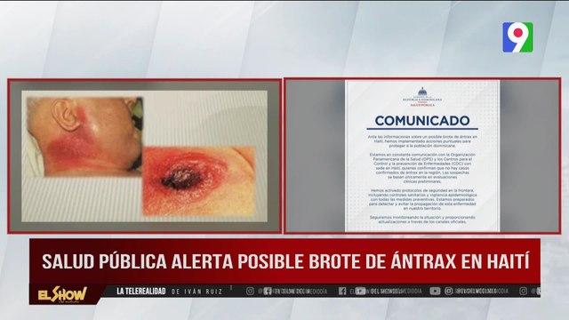 ¡Alerta! Salud Publica emite comunicado que niega casos positivos de ántrax en RD| El Show del Mediodía