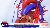 Enfermedad arterial periférica - XXXI Congreso Puertorriqueño de Cardiología