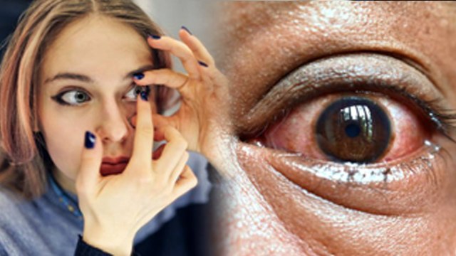 Side Effects of Wearing Colored Contact Lenses | Colored Contact Lenses Pehnne Se Kya Hota Hai |