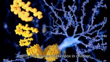 Shingles Vaccine Offers Hope Against Dementia