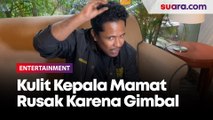 Totalitas! Kulit Kepala Mamat Alktiri Sampai Rusak Demi Tampil Gimbal di Film Kaka Boss