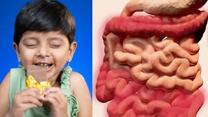 What Causes Worms In The Stomach: Meetha Khane Se Pet Me Kide Hote Hai Kya | Boldsky