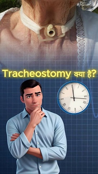 Tracheostomy के रहस्यमय सच, tracheostomy kab aur kyun ? #tracheostomy #shorts #viralvideo #facts