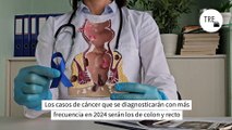 Cáncer colorrectal: el principal síntoma de alerta que no deberíamos pasar por alto