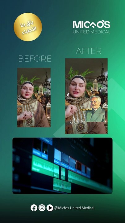 MU Media | Before and After Montage and Editing