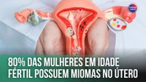 80% das mulheres em idade fértil possuem miomas no útero | Fala, Doutora!