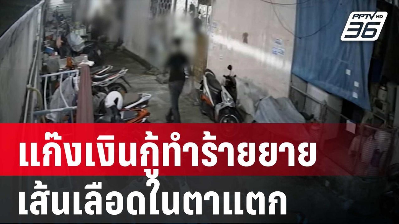 ยายวัย 72 ปี ร้องแก๊งเงินกู้ทำร้ายเส้นเลือดในตา...