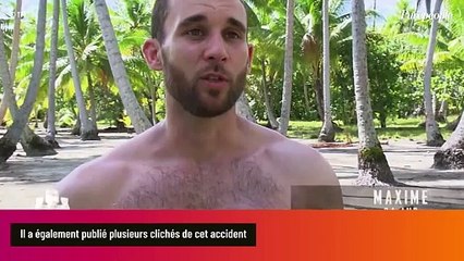 Koh-Lanta : Un candidat emblématique perd une partie de ses doigts, une greffe "impossible" et des images impressionnantes