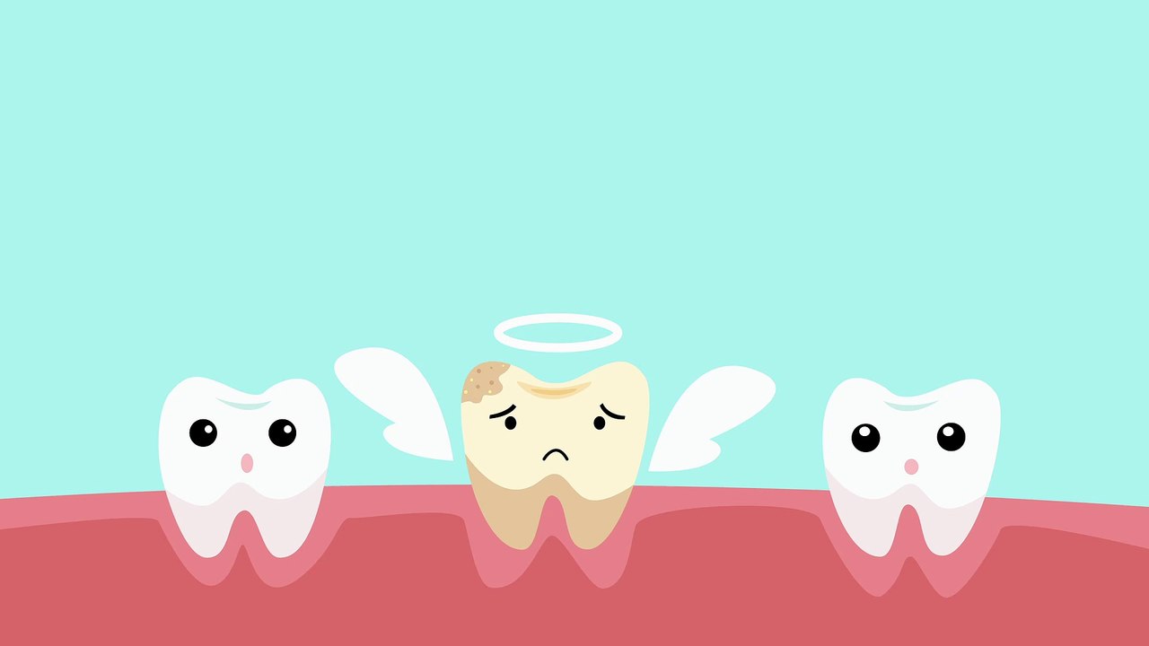 Tooth Decay will result in its loss!!