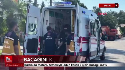 Bartın'da motorlu testereyle odun kesen kişinin bacağı koptu