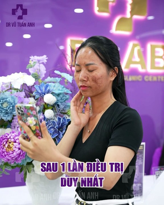 #178 daily c Minh xấu, đẹp, feedback - 29.07 - 180 - h05