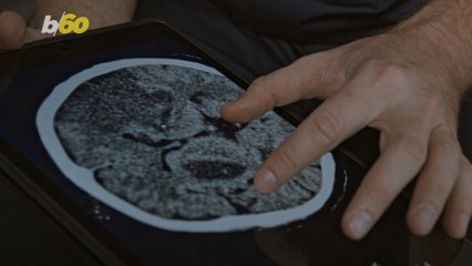 This New Blood Test Identifies Alzheimer's Memory Loss Near Perfect Accuracy