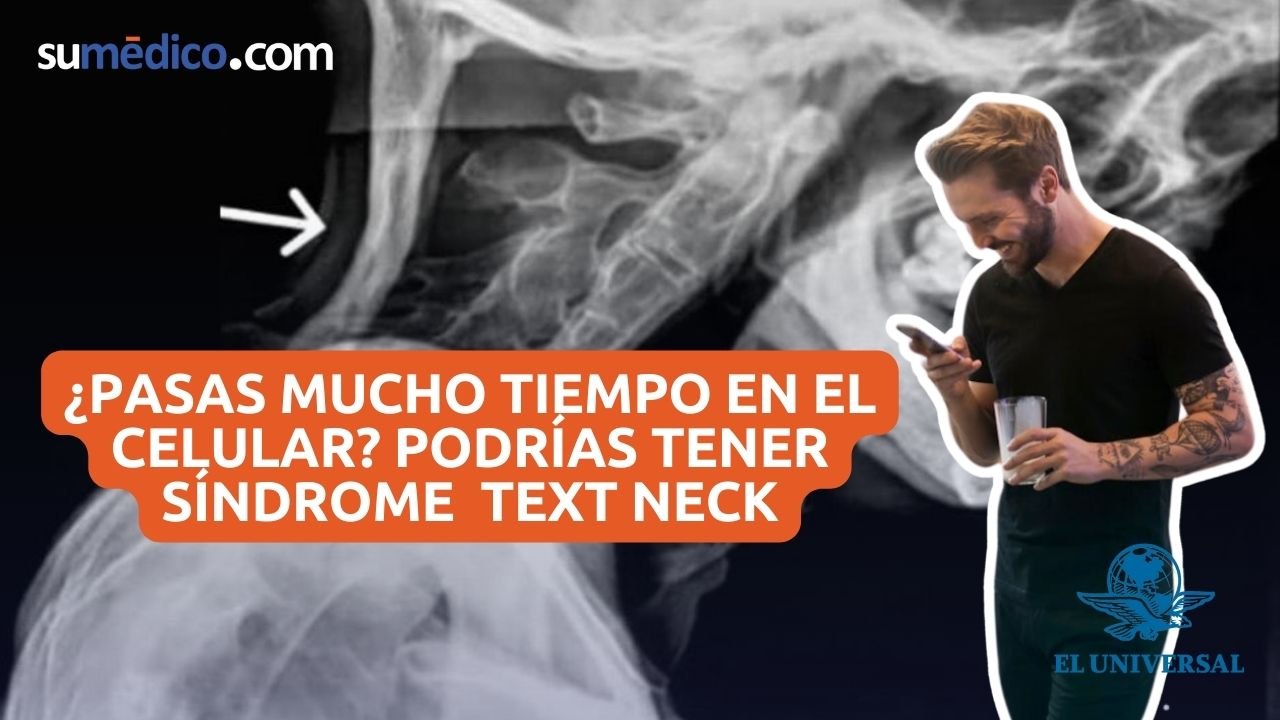 ¿Qué es la enfermedad tecnológica del Síndrome de Cuello de Texto?