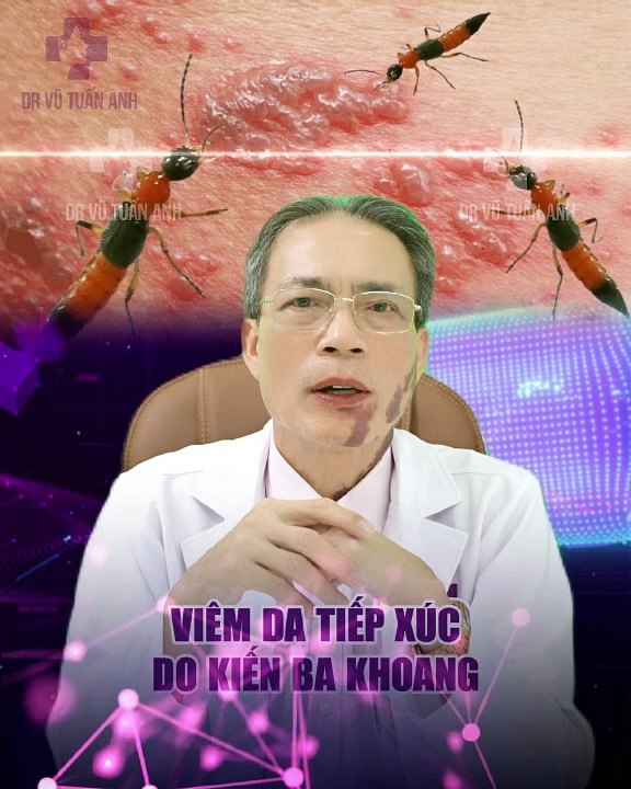 #183 LỆ ADS 72023 kiến ba khoang-29.7-182-H01 fina