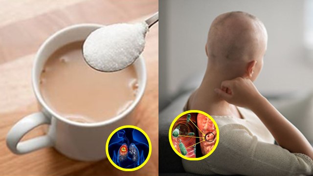 Cancer Myths & Facts : चीनी खाने से कैंसर होता है क्या | Sugar Khane Se Cancer Hota Hai | Boldsky