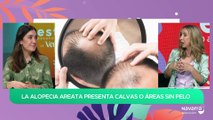 Causas y tratamiento para la alopecia areata