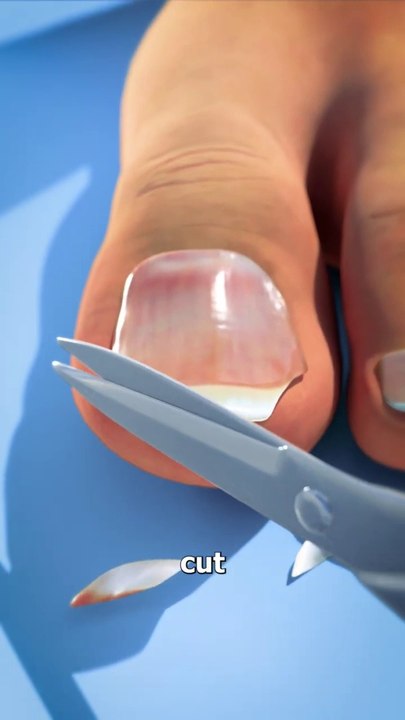 Don't%20Cut%20Your%20Toenails%20Like%20This%20%F0%9F%98%A8%E2%9C%82%EF ...