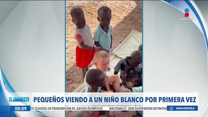 Niños ven a un niño con tez blanca por primera vez