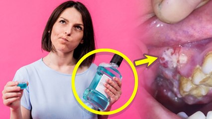 Mouthwash Karne Se Kya Hota Hai | Does Mouthwash Cause Cancer, FACT CHECK...|Boldsky