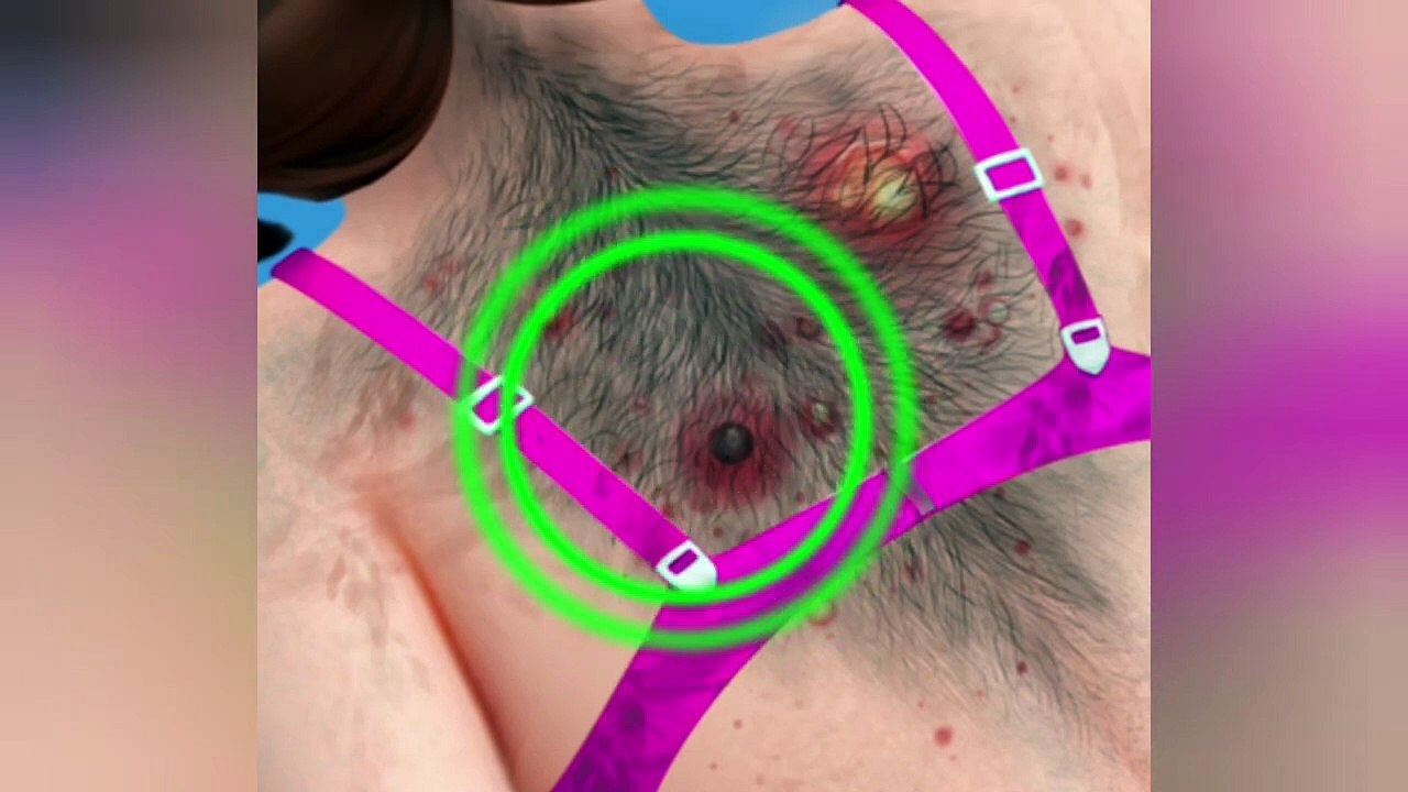 ASMR RELAX} RANDOM ASMR INFECTION - MOUTH MAGGOTS REMOVEL TREATMENT - ANIMATION -  Episode 5