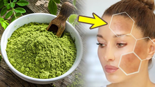 Moringa Powder Ko Face Par Lagane Ke Fayde| Sahjan Benefits For Skin In Hindi |Boldsky