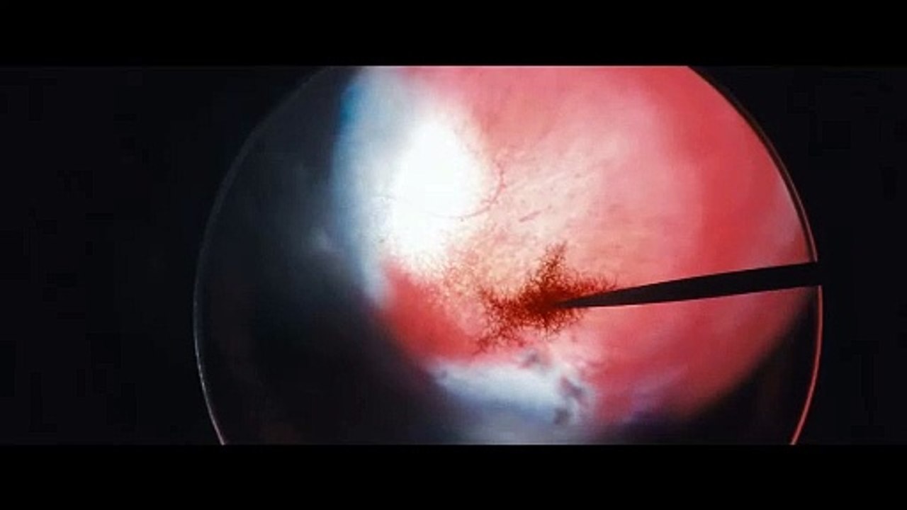 FUNGUS Movie