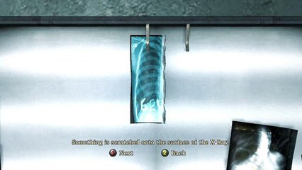 Silent Hill: Homecoming Pt.1-I Hate Those Nurses