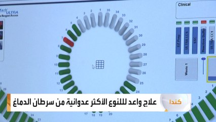 علاج واعد للنوع الأكثر عدوانية من سرطان الدماغ