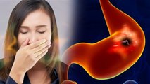 Khatti Dakar के बाद मुंह में खाना आना Stomach Ulcer से लेकर Gastroesophageal Reflux Disease Reason