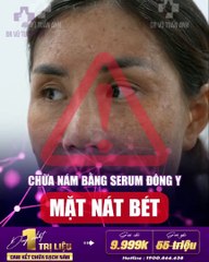 #213 Lệ ADS 82023-2.8-13-h01 finalll