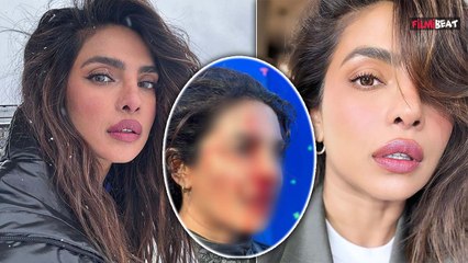Priaynka Chopra के साथ हुआ बड़ा हादसा, 'The Bluff' की Shooting करते हुए लगी चोट, परेशान हुए Fans