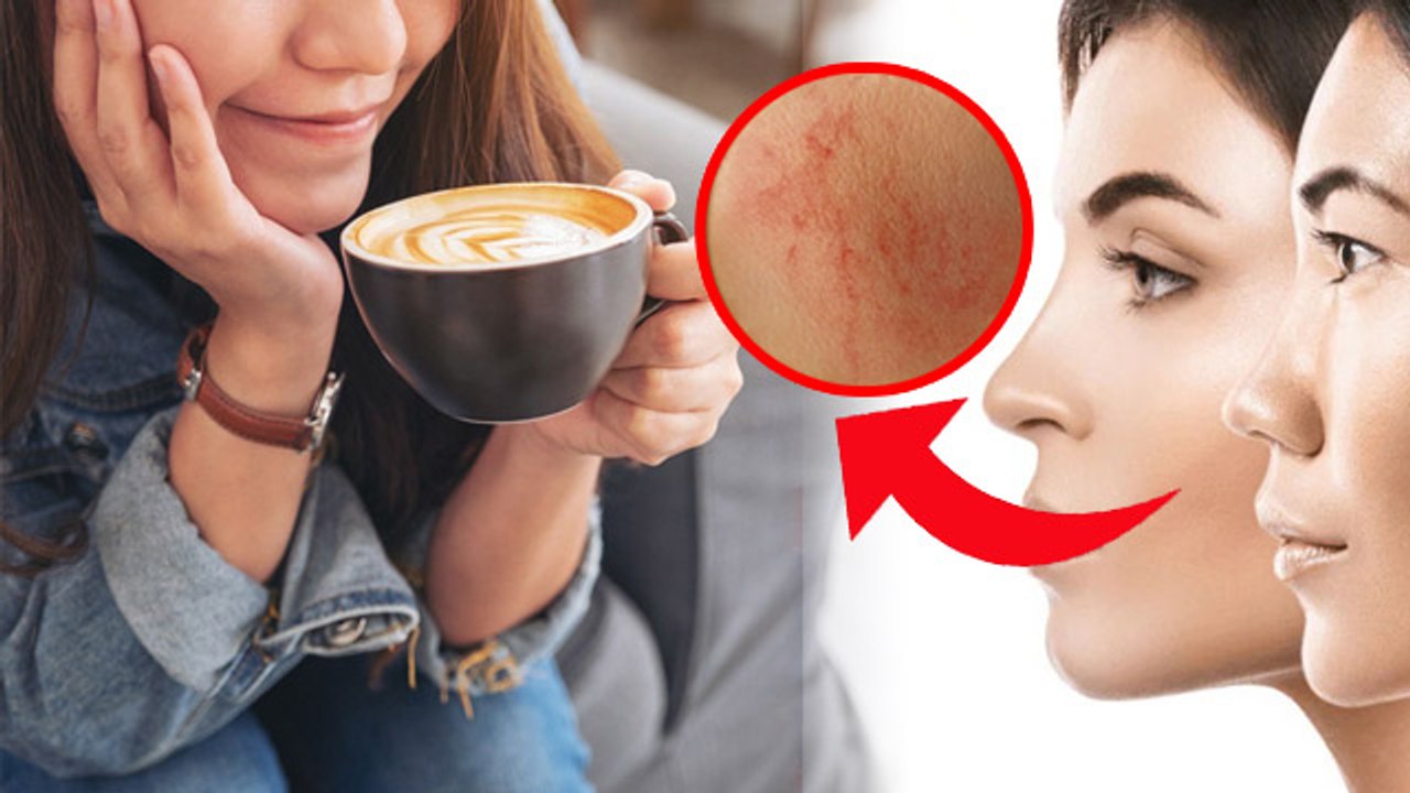 Coffee Side Effect On Skin and Face: Coffee Pine Se Chehre Par Kya Hota ...