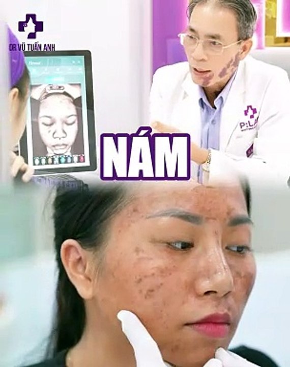 #225 CĐ Nám khi còn trẻ - 05.08 - 44 - H04