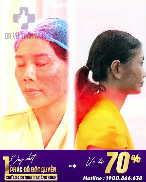 #233 CĐ Xấu đẹp, mẫu cuối t7 - 06.08 - 50 - H04