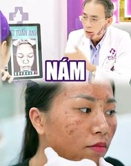 #225 CĐ Nám khi còn trẻ - 05.08 - 44 -H04(1)