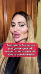 Anastasia, la femme aux plus grosses joues, va encore plus loin dans sa transformation
