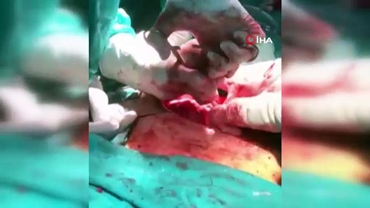''Ağrım var'' diye hastaneye başvurdu, mesanesinden çıkana kimse inanamadı